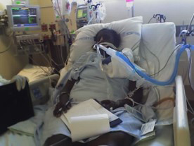E-Denise-Peoples-4 | NJ Sharing Network Patient in a hospital bed connected to a ventilator with tubing and an oxygen mask, surrounded by medical monitors and IV equipment.